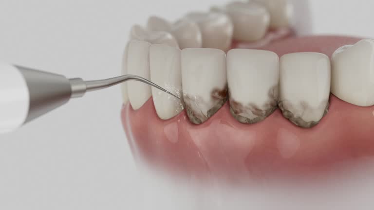 Trusted Invisalign Clear Aligners service in Jackson, MS - Dentist Open Now